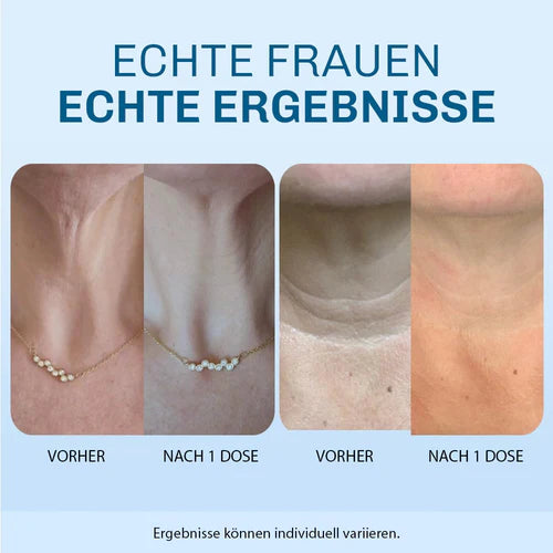 Halsfalten Lifting Creme