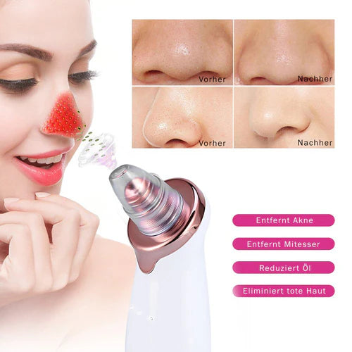 Mitesserentferner SkinClear 3
