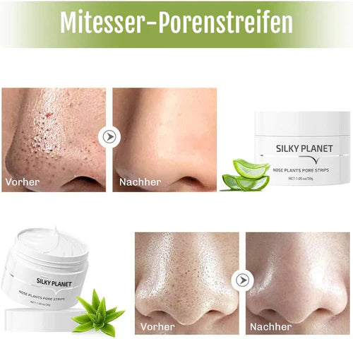 Mitesser Entferner Creme