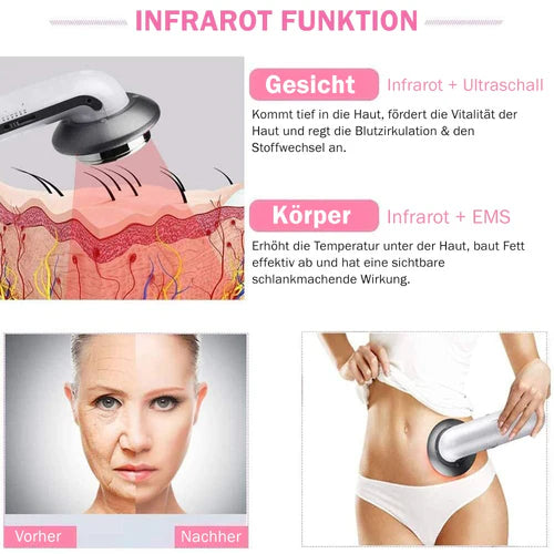 Anticellulite Gerät CelluX