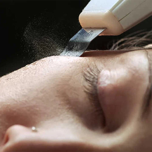 Ultraschall Peeling Gerät DermaGlow 5