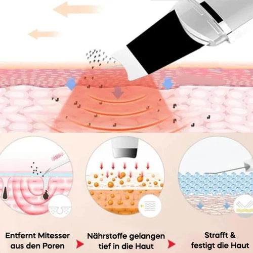 Ultraschall Peeling Gerät DermaGlow 5