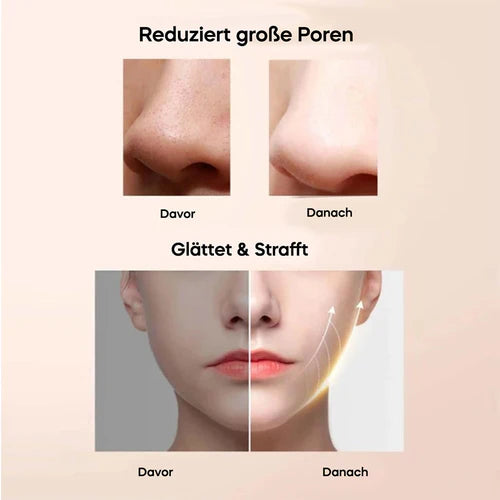 Ultraschall Peeling Gerät DermaGlow 5