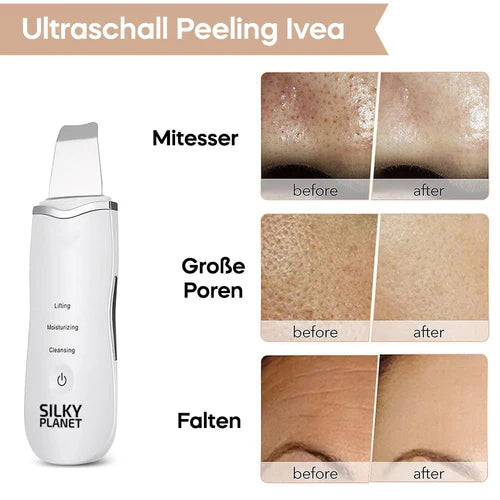 Ultraschall Peeling Gerät DermaGlow 5