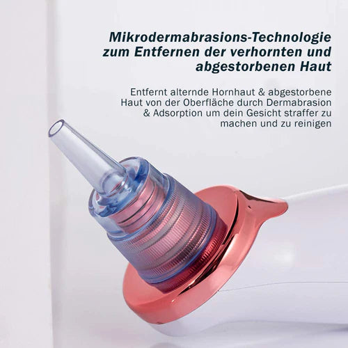 Mitesserentferner SkinClear 3
