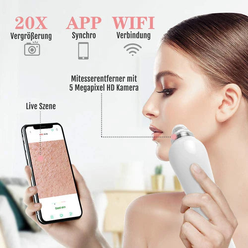 Mitesserentferner mit Kamera